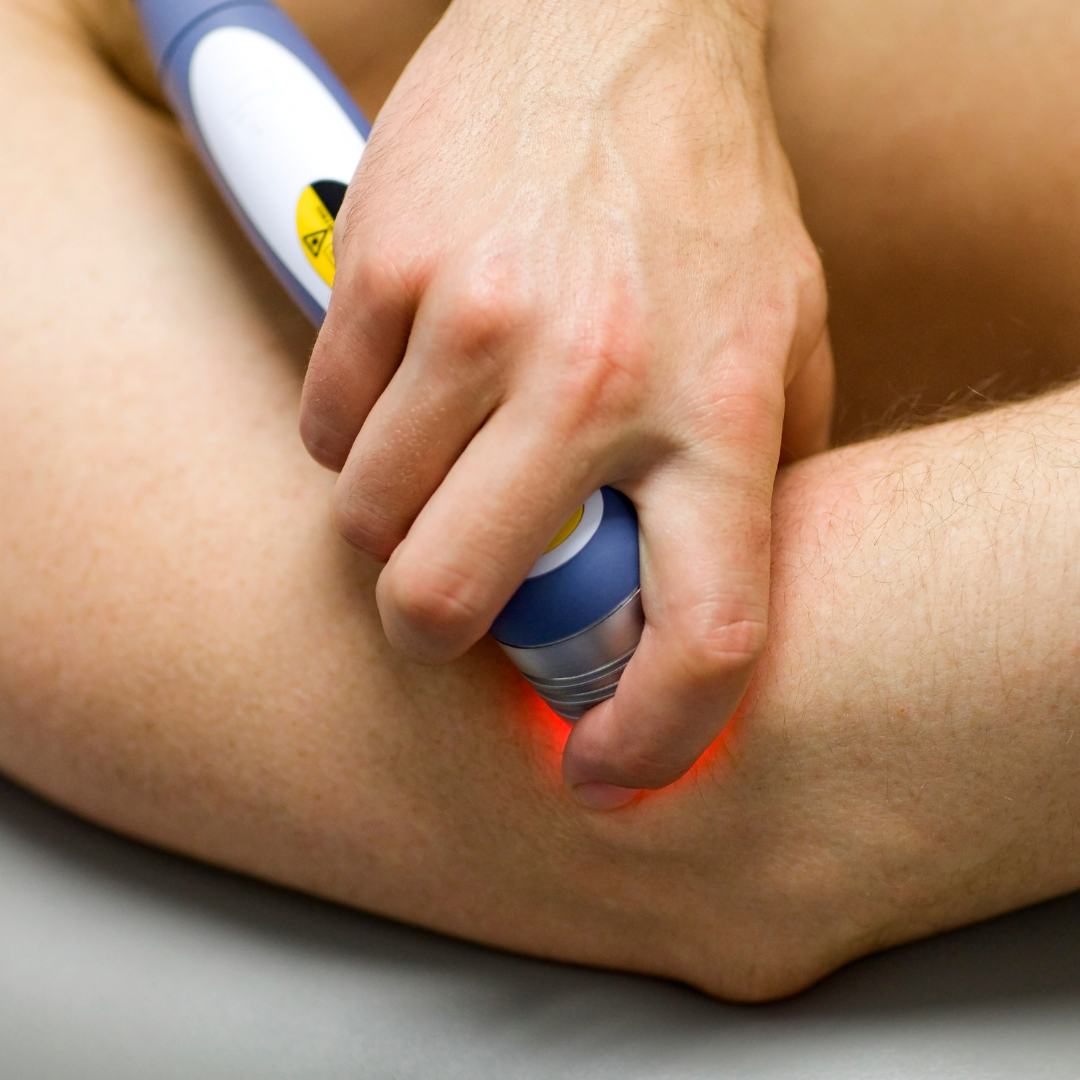 Laser Therapy on Elbow